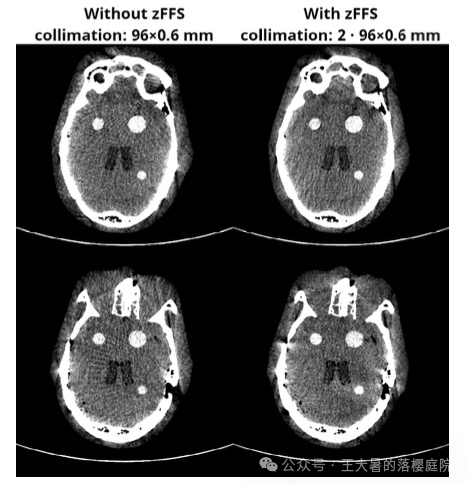 #108 CT重建的3D深度学习技术——深度学习图像重建算法分类2 #108 CT重建的3D深度学习技术——深度学习图像重建算法分类2
